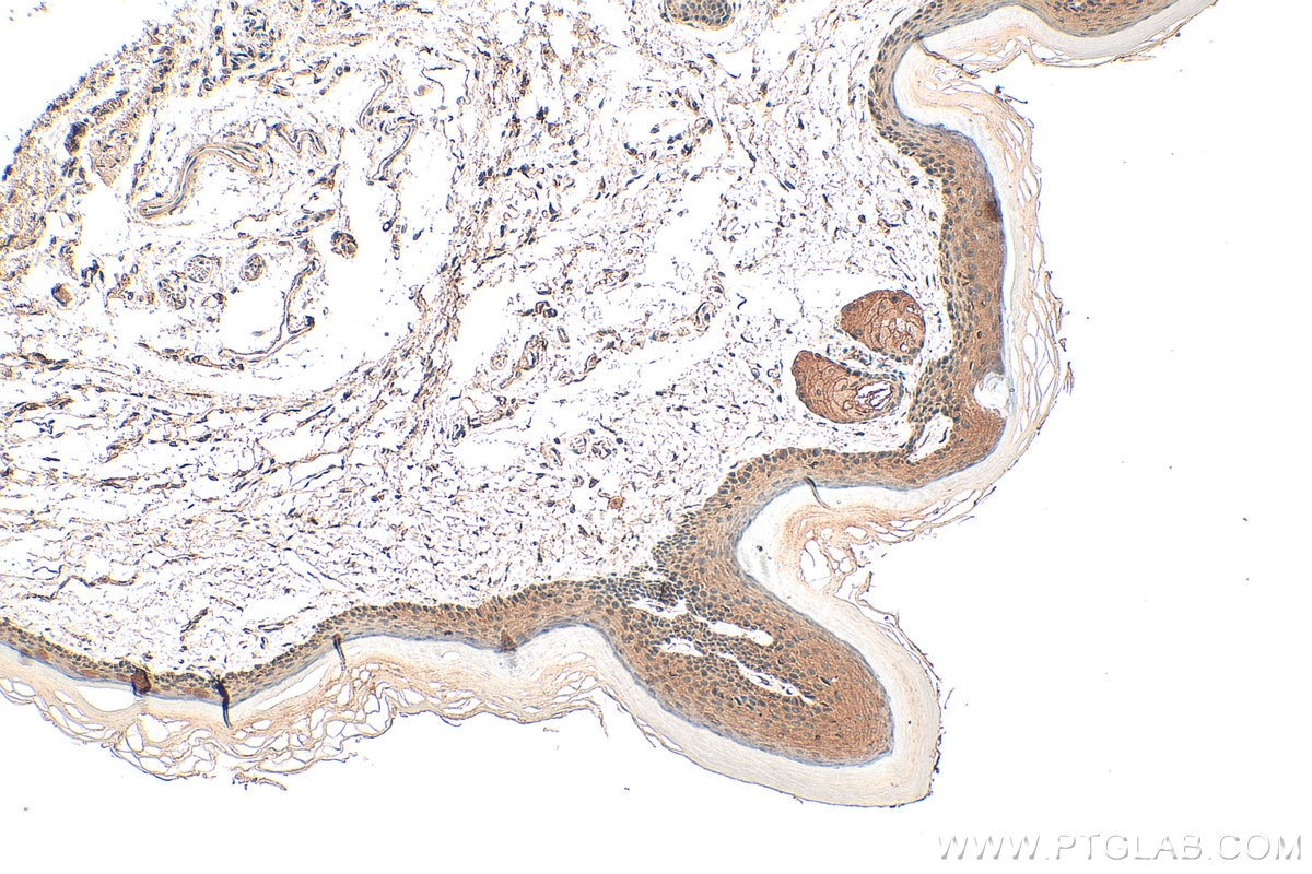 Immunohistochemistry (IHC) staining of mouse skin tissue using MLKL Monoclonal antibody (66675-1-Ig)