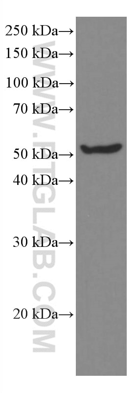 Western Blot (WB) analysis of 4T1 cells using MLKL Monoclonal antibody (66675-1-Ig)
