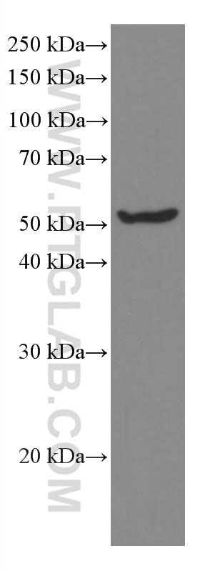 WB analysis of 4T1 using 66675-1-Ig
