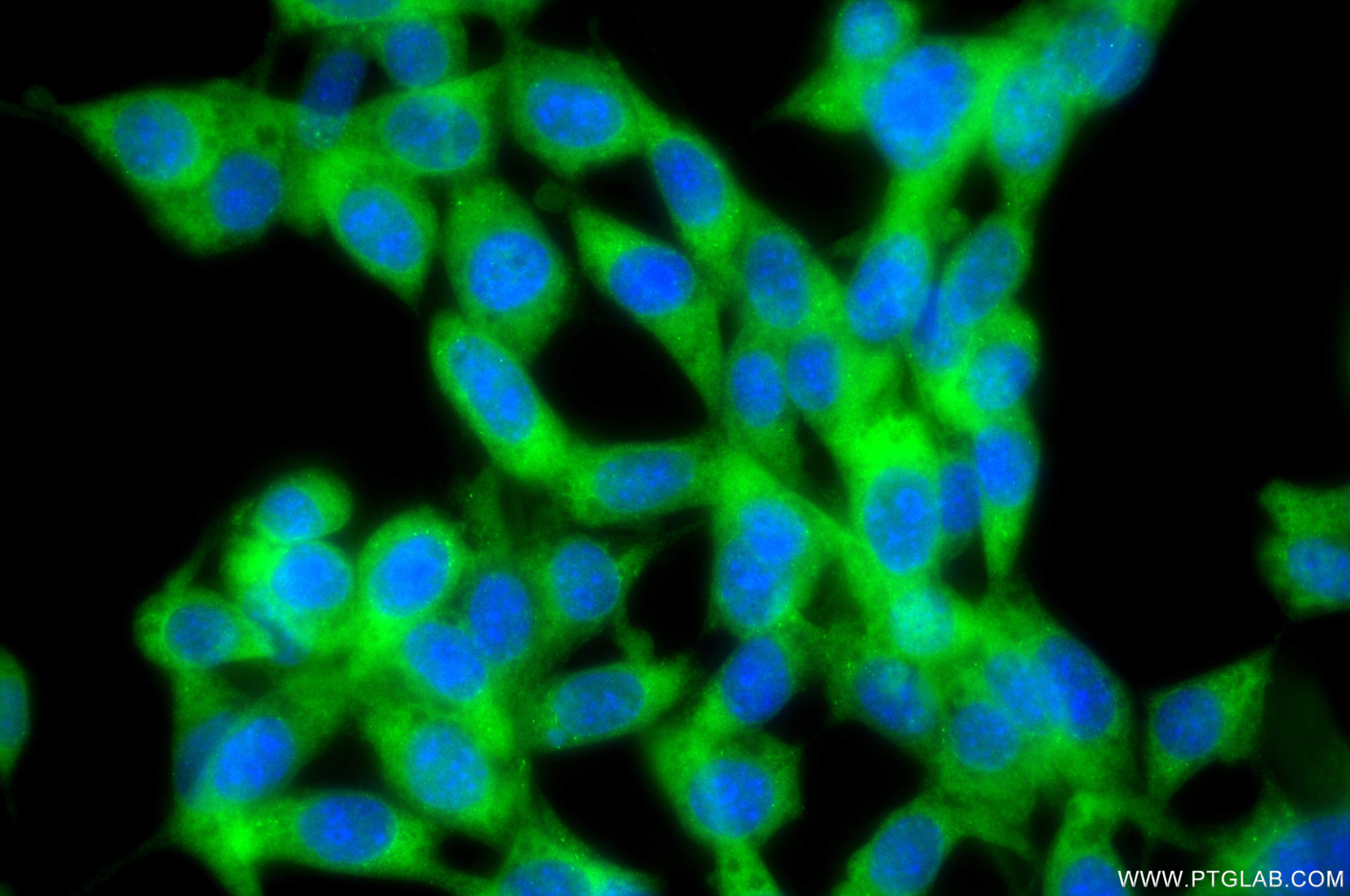 MLKL (Y8) Rabbit mAb main image 0