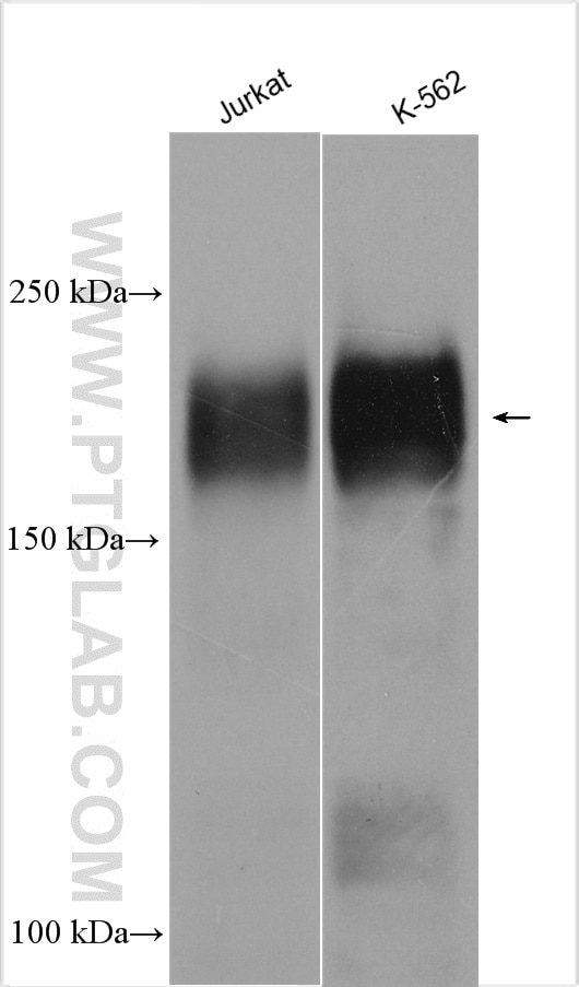 Western Blot (WB) analysis of various lysates using MLL Polyclonal antibody (29278-1-AP)