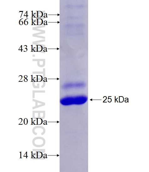 MLL fusion protein Ag27159 SDS-PAGE