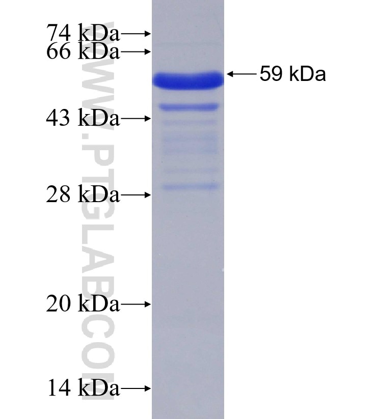 MLL fusion protein Ag30468 SDS-PAGE