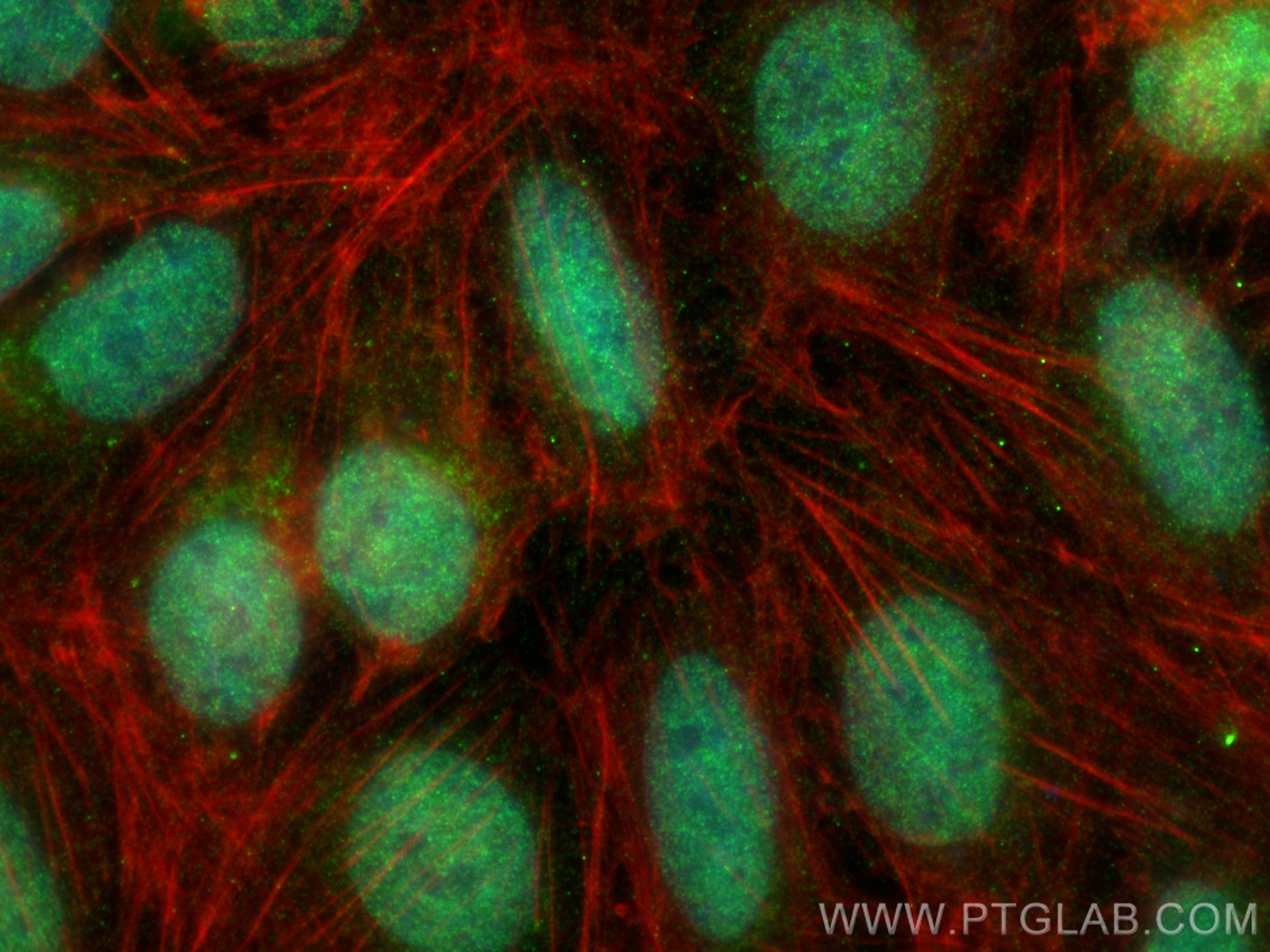 Immunofluorescence (IF) / fluorescent staining of U2OS cells using MLL4 Polyclonal antibody (31396-1-AP)