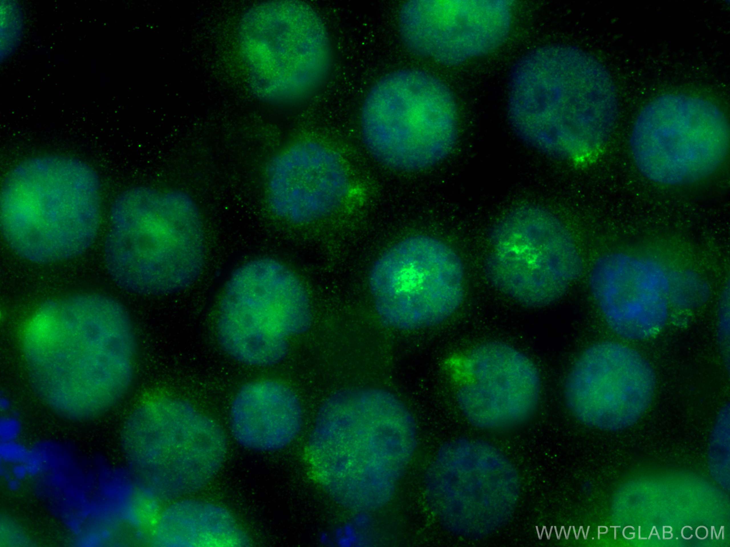 Immunofluorescence (IF) / fluorescent staining of K-562 cells using MLL5 Polyclonal antibody (14540-1-AP)