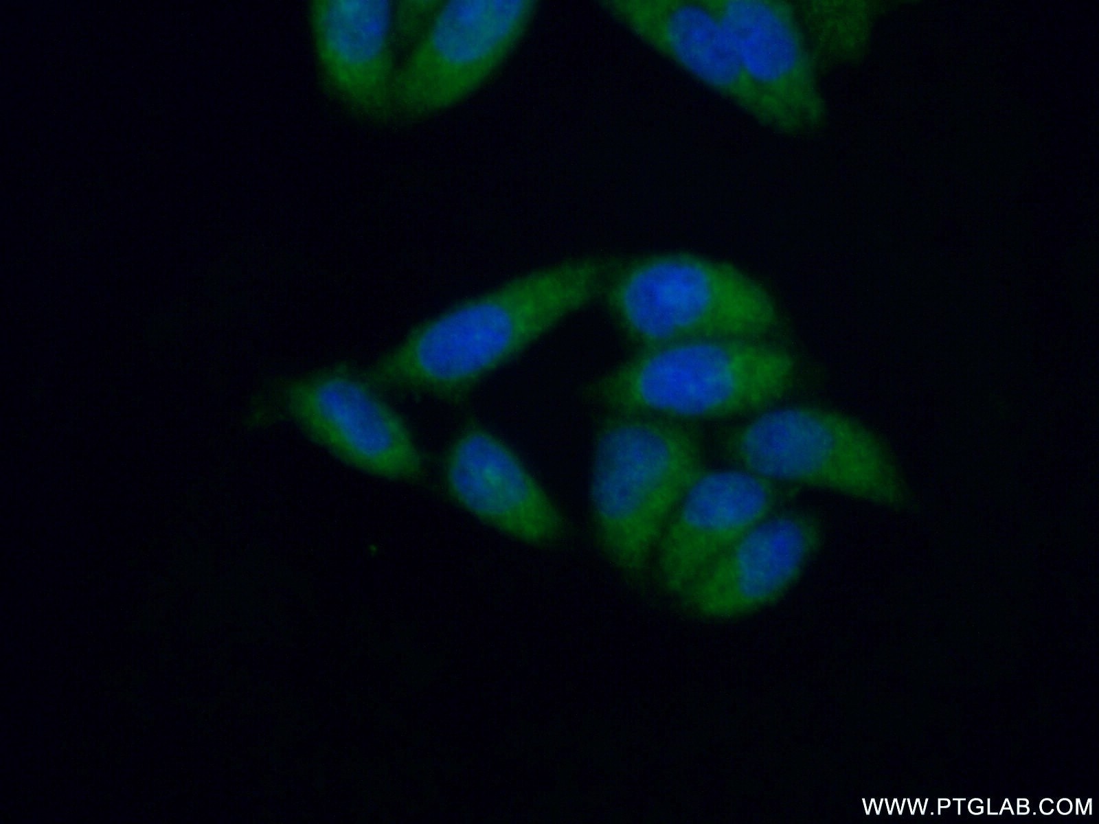 Immunofluorescence (IF) / fluorescent staining of HeLa cells using MLL5 Polyclonal antibody (14540-1-AP)