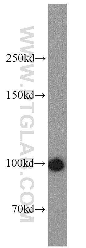 WB analysis of HL-60 using 14540-1-AP