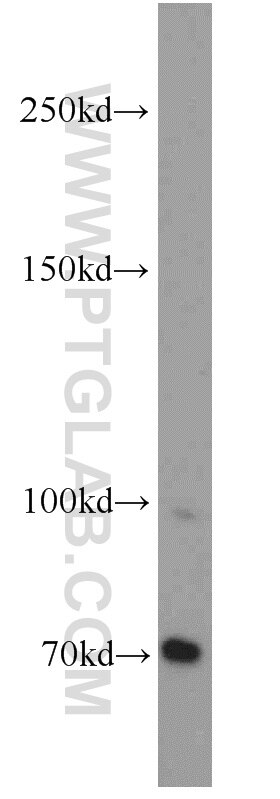 Western Blot (WB) analysis of Jurkat cells using MLL5 Polyclonal antibody (14540-1-AP)