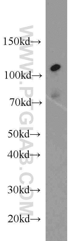 Western Blot (WB) analysis of mouse brain tissue using MLL5 Polyclonal antibody (14540-1-AP)