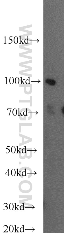 Western Blot (WB) analysis of HeLa cells using MLL5 Polyclonal antibody (14540-1-AP)