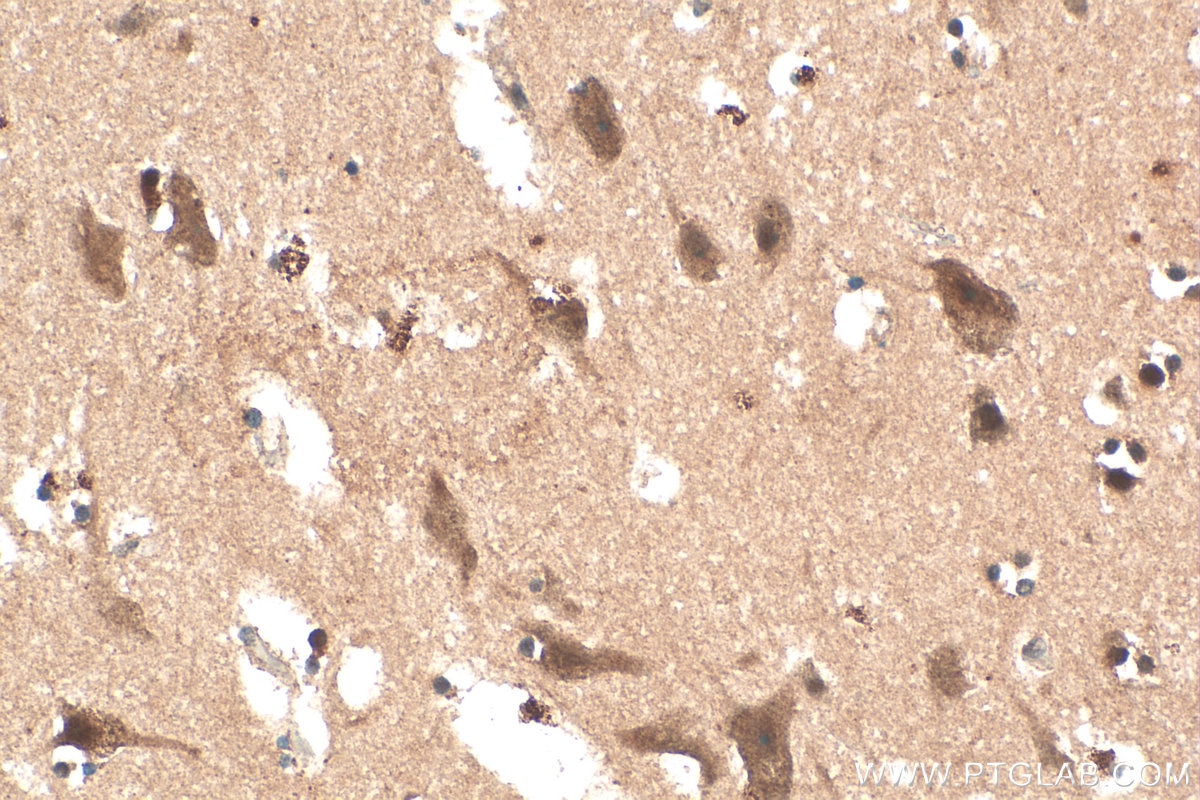 Immunohistochemistry (IHC) staining of human brain tissue using MLLT1 Polyclonal antibody (31029-1-AP)