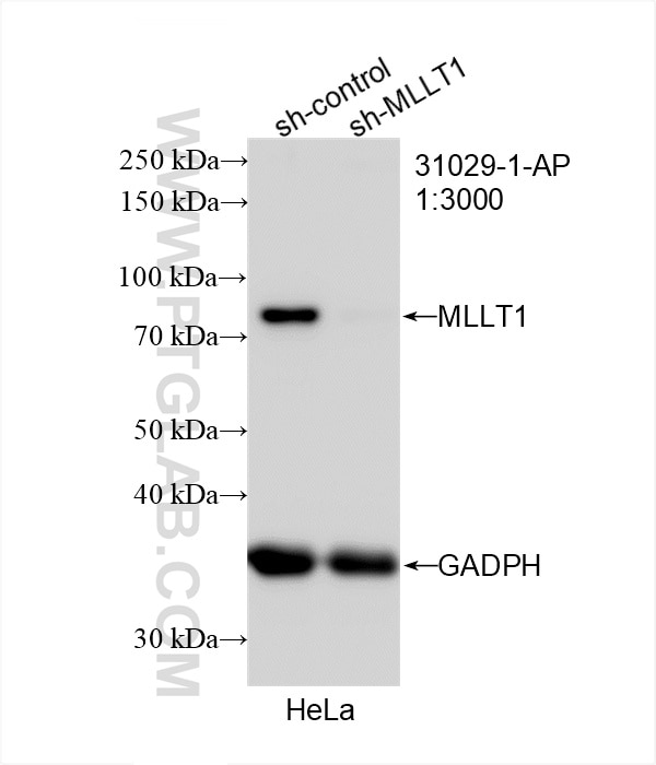 Western Blot (WB) analysis of HeLa cells using MLLT1 Polyclonal antibody (31029-1-AP)