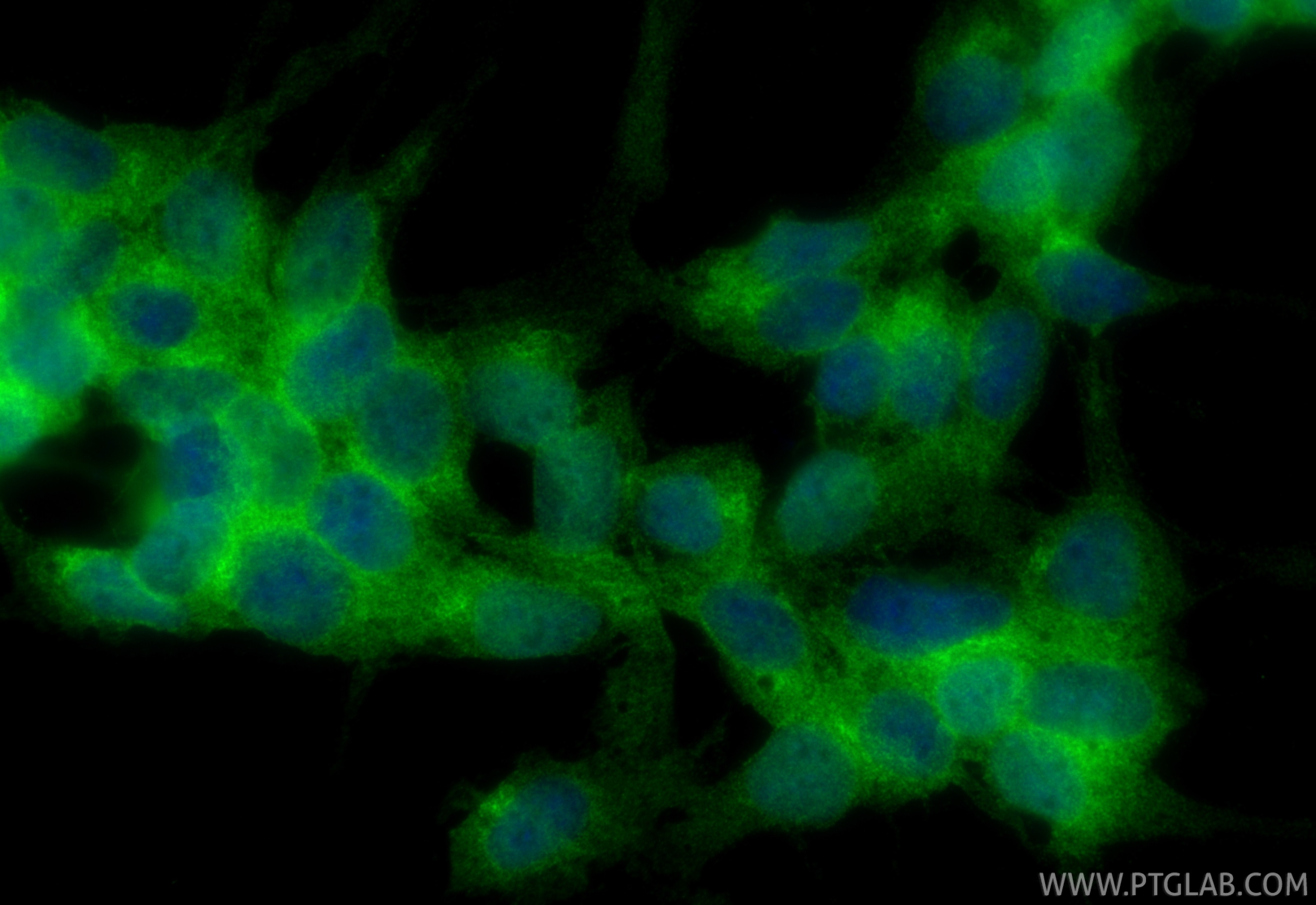 IF Staining of SH-SY5Y using 12062-1-AP (same clone as 12062-1-PBS) Immunofluorescence (IF) / fluorescent staining of SH-SY5Y cells using MLLT11 Polyclonal antibody (12062-1-AP)