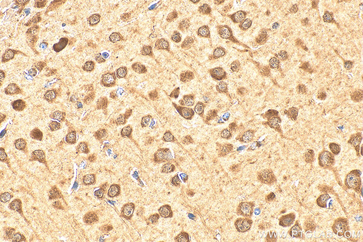 Immunohistochemistry (IHC) staining of mouse brain tissue using MLLT11 Polyclonal antibody (12062-1-AP)