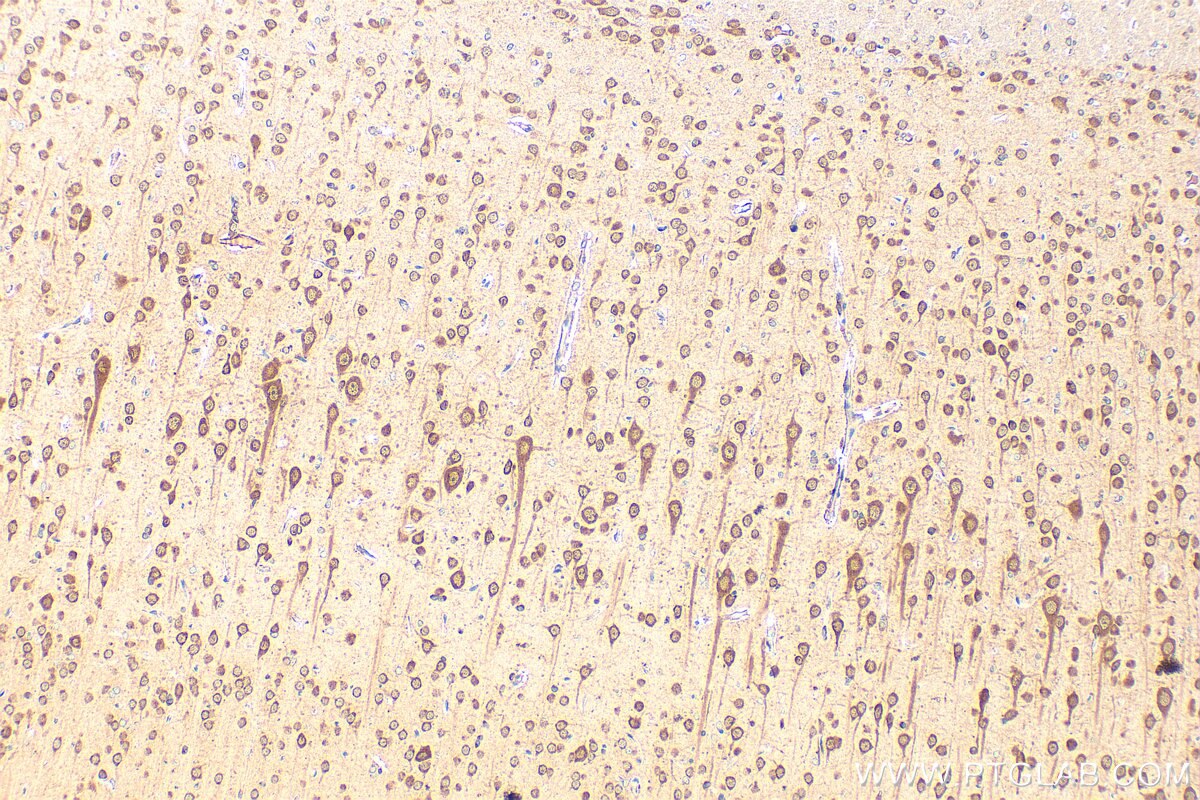 Immunohistochemistry (IHC) staining of rat brain tissue using MLLT11 Polyclonal antibody (12062-1-AP)