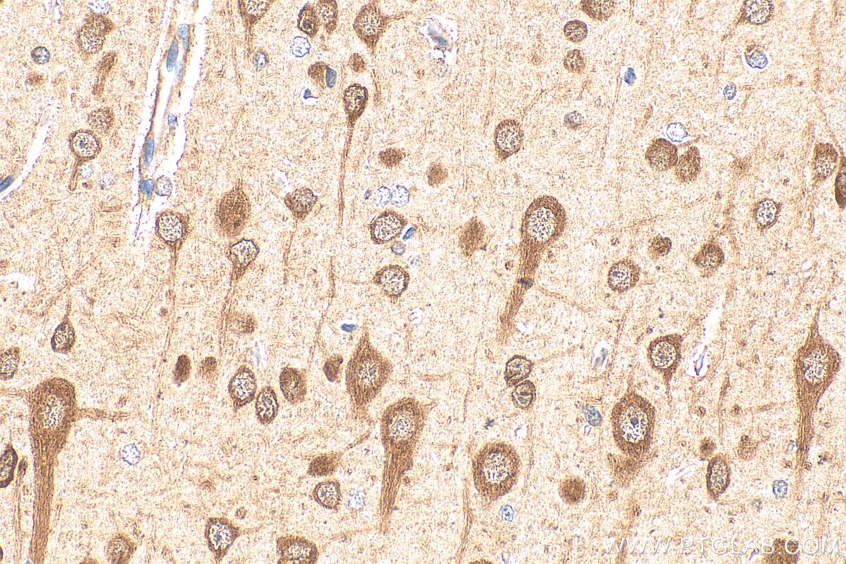 Immunohistochemistry (IHC) staining of rat brain tissue using MLLT11 Polyclonal antibody (12062-1-AP)
