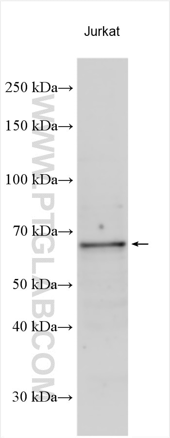 Western Blot (WB) analysis of Jurkat cells using MLLT3/AF9 Polyclonal antibody (12825-1-AP)