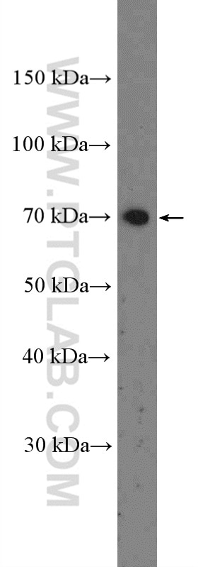 Western Blot (WB) analysis of Jurkat cells using MLLT3/AF9 Polyclonal antibody (12825-1-AP)