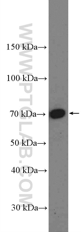 Western Blot (WB) analysis of HL-60 cells using MLLT3/AF9 Polyclonal antibody (12825-1-AP)