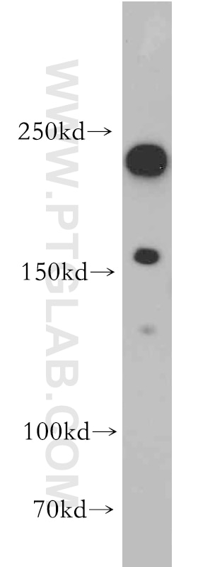 Western Blot (WB) analysis of A431 cells using AF-6 Polyclonal antibody (55102-1-AP)