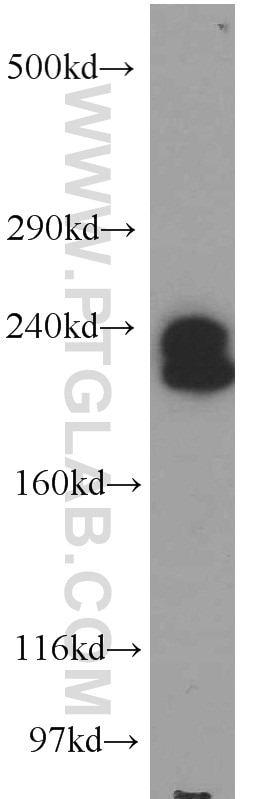 Western Blot (WB) analysis of human brain tissue using AF-6 Polyclonal antibody (55102-1-AP)