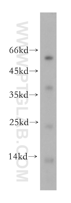 Western Blot (WB) analysis of human colon tissue using MLN Polyclonal antibody (18824-1-AP)