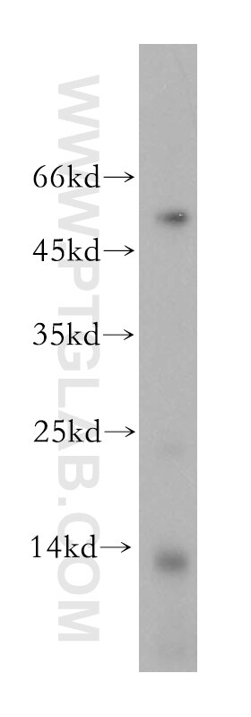 Western Blot (WB) analysis of human ileum tissue using MLN Polyclonal antibody (18824-1-AP)