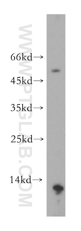 Western Blot (WB) analysis of human stomach tissue using MLN Polyclonal antibody (18824-1-AP)