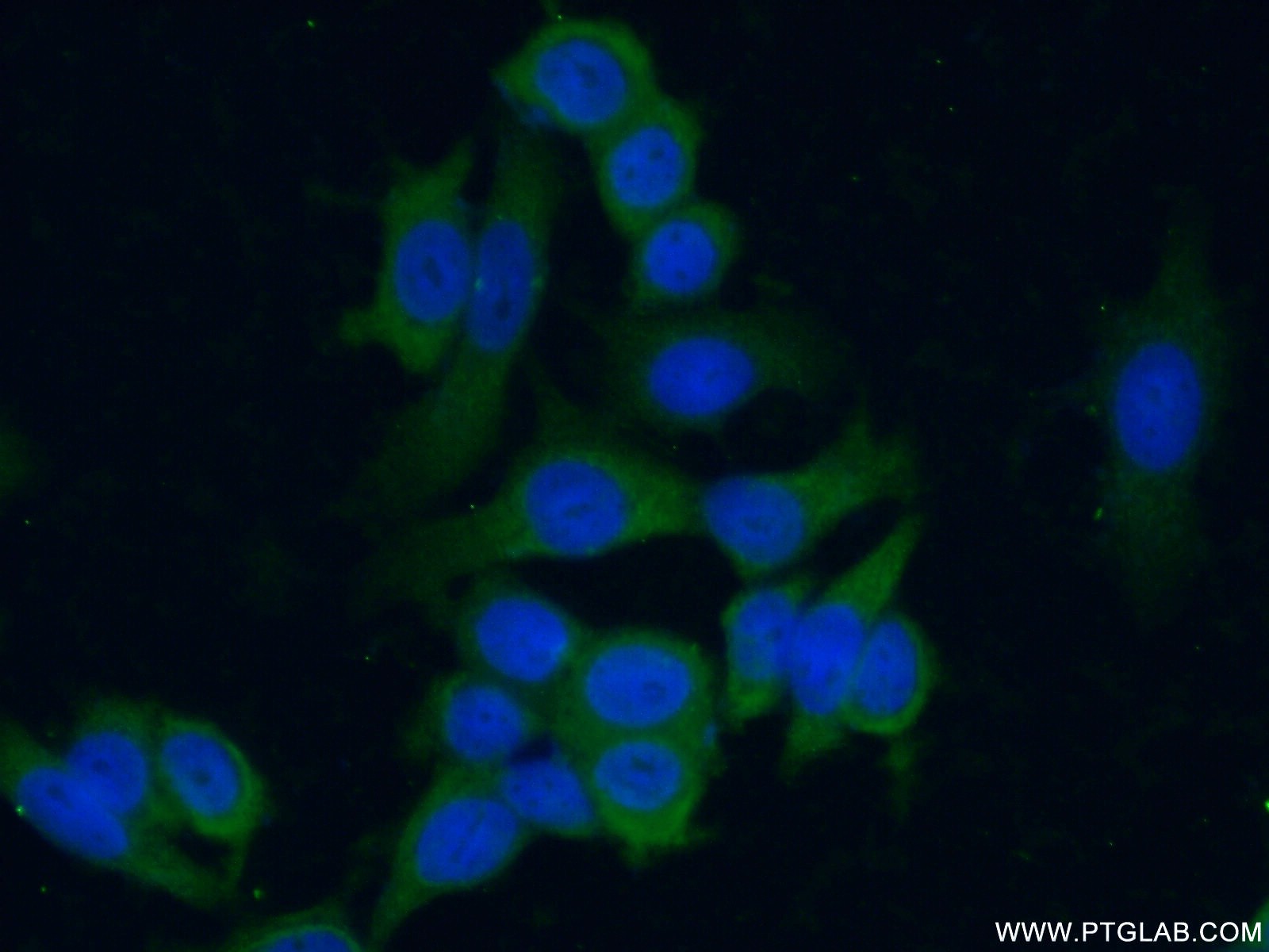 Immunofluorescence (IF) / fluorescent staining of MCF-7 cells using MLN64 Polyclonal antibody (20292-1-AP)