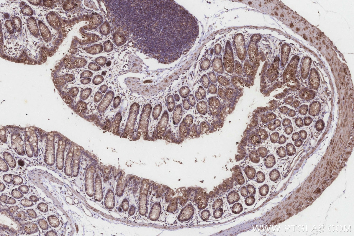 IHC staining of mouse colon using 20292-1-AP Immunohistochemistry (IHC) staining of mouse colon tissue using MLN64 Polyclonal antibody (20292-1-AP)