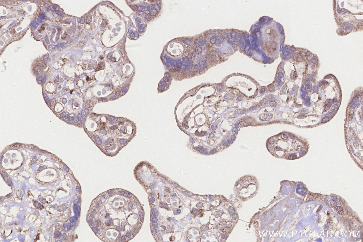 IHC staining of human placenta using 20292-1-AP Immunohistochemistry (IHC) staining of human placenta tissue using MLN64 Polyclonal antibody (20292-1-AP)
