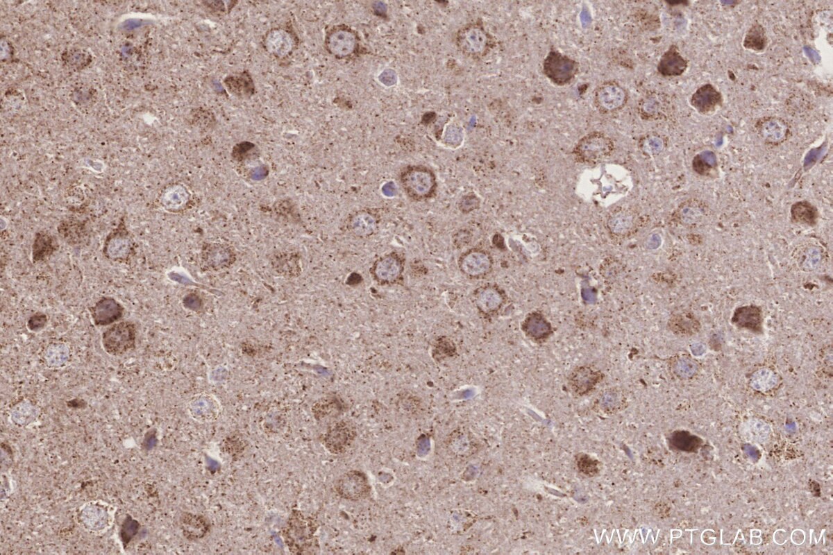 IHC staining of mouse brain using 20292-1-AP Immunohistochemistry (IHC) staining of mouse brain tissue using MLN64 Polyclonal antibody (20292-1-AP)