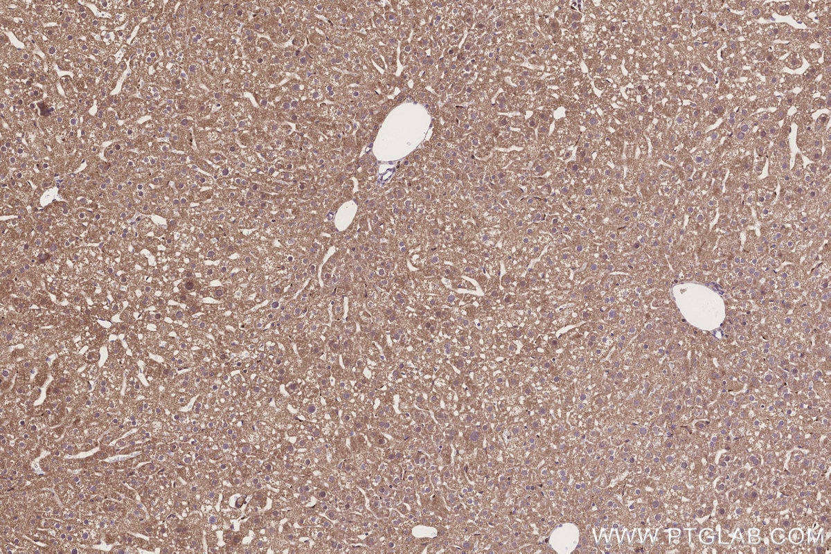 IHC staining of mouse liver using 20292-1-AP Immunohistochemistry (IHC) staining of mouse liver tissue using MLN64 Polyclonal antibody (20292-1-AP)