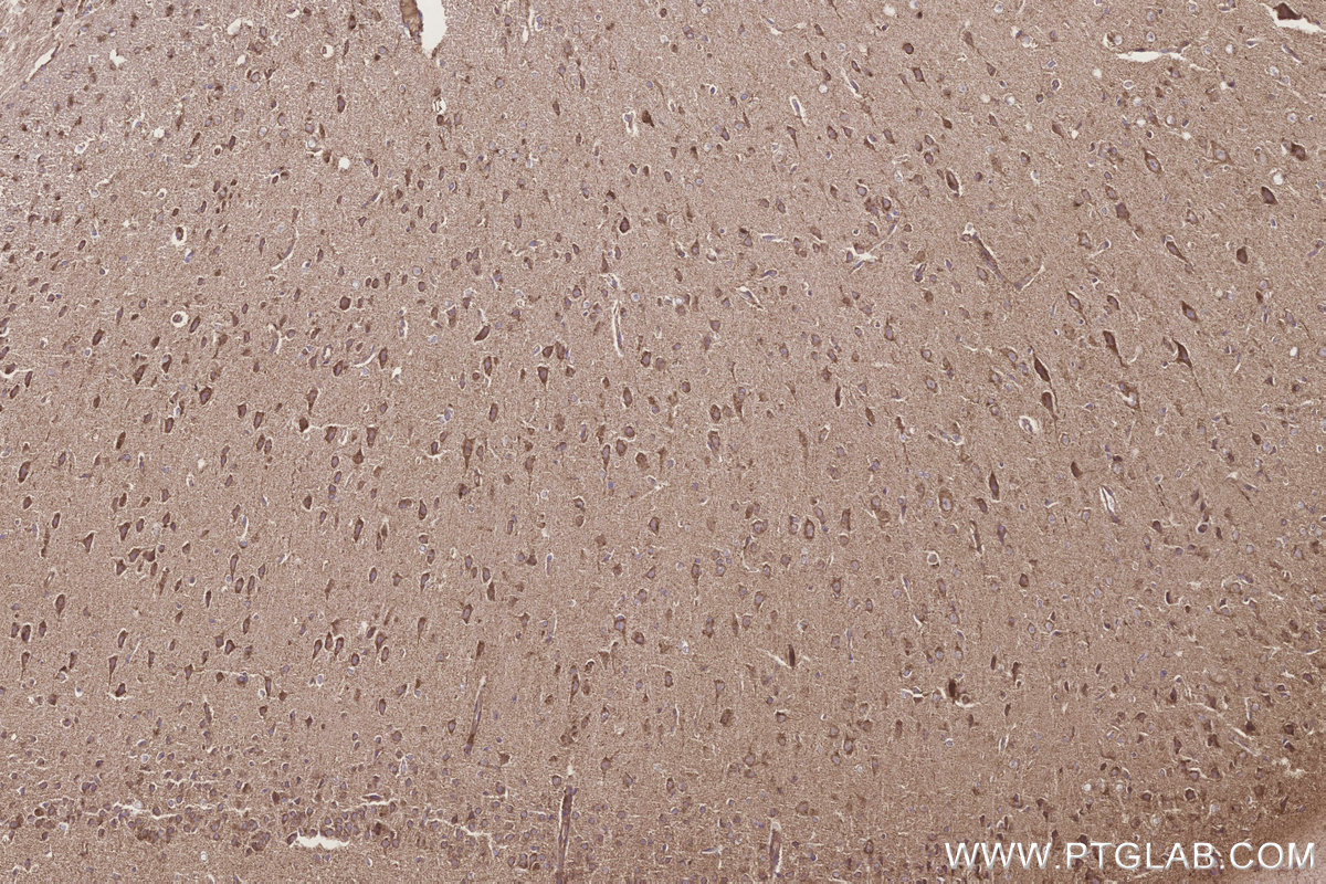IHC staining of rat brain using 20292-1-AP Immunohistochemistry (IHC) staining of rat brain tissue using MLN64 Polyclonal antibody (20292-1-AP)