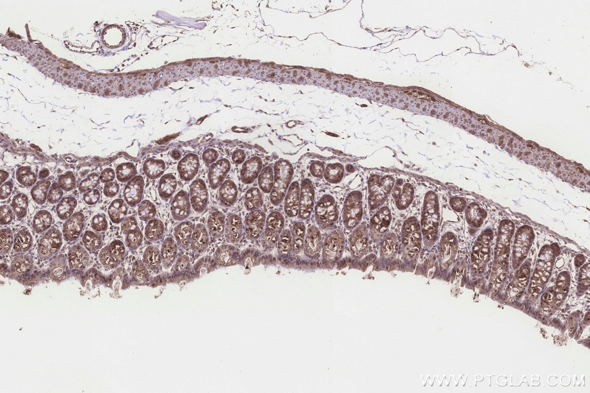 IHC staining of rat colon using 20292-1-AP Immunohistochemistry (IHC) staining of rat colon tissue using MLN64 Polyclonal antibody (20292-1-AP)