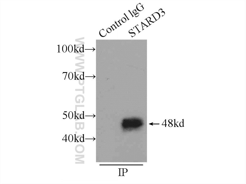 Immunoprecipitation (IP) experiment of MCF-7 cells using MLN64 Polyclonal antibody (20292-1-AP)