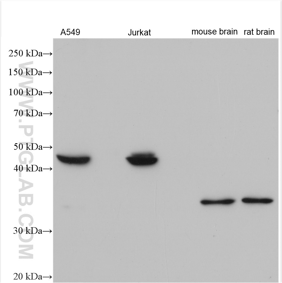 Western Blot (WB) analysis of various lysates using MLN64 Polyclonal antibody (20292-1-AP)
