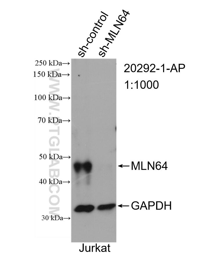 Western Blot (WB) analysis of Jurkat cells using MLN64 Polyclonal antibody (20292-1-AP)