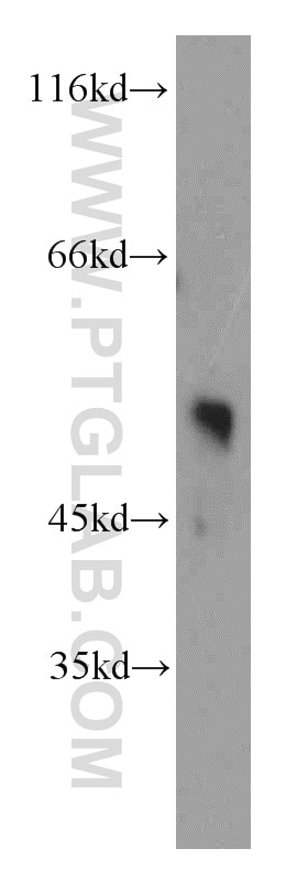 Western Blot (WB) analysis of mouse placenta tissue using MLN64 Polyclonal antibody (20292-1-AP)