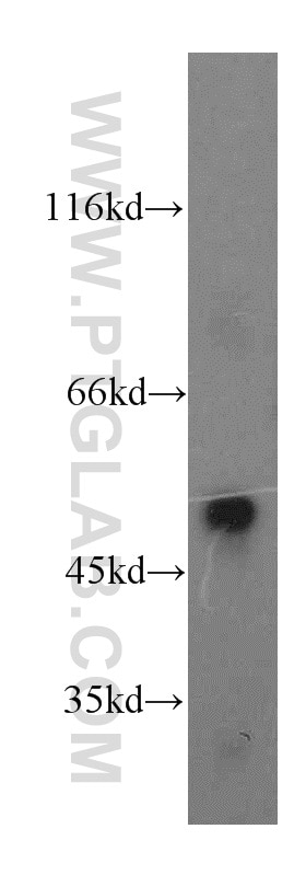 Western Blot (WB) analysis of MCF-7 cells using MLN64 Polyclonal antibody (20292-1-AP)