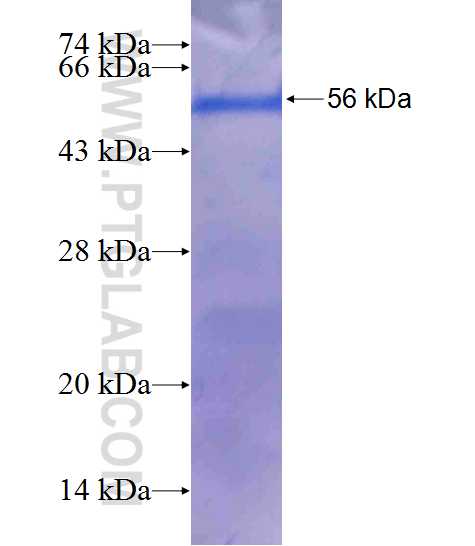 MLN64,STARD3 fusion protein Ag14061 SDS-PAGE