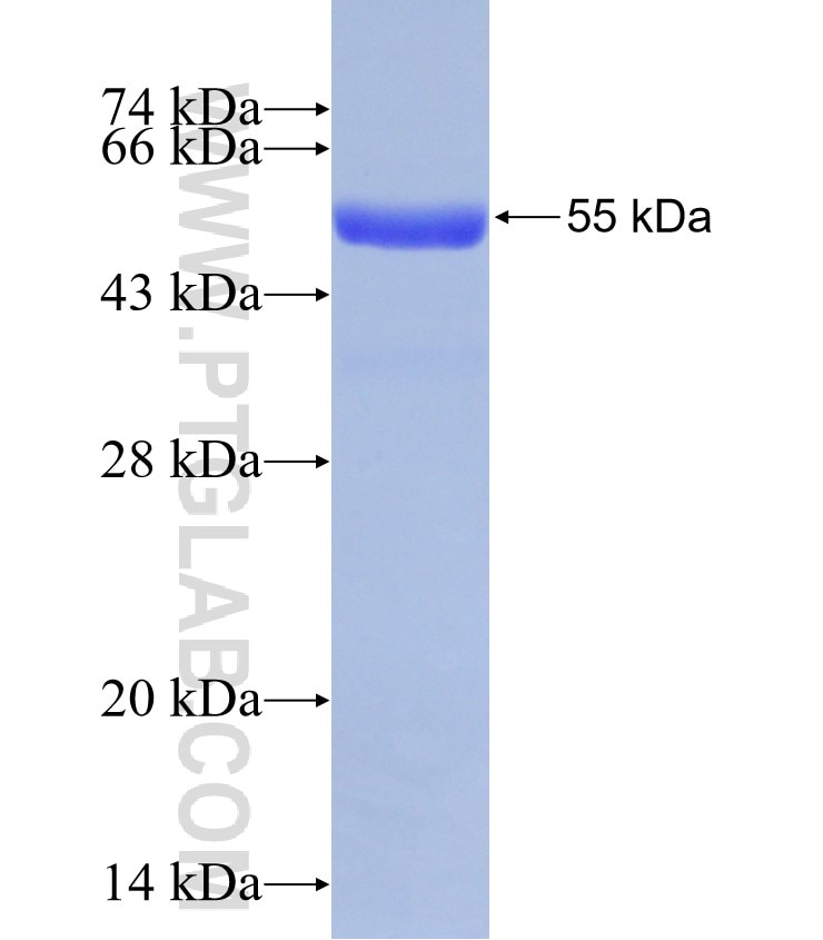 MLN64,STARD3 fusion protein Ag31477 SDS-PAGE