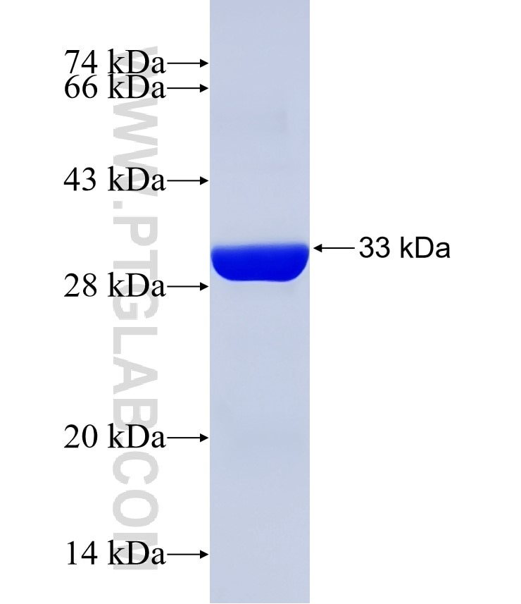 MLN64,STARD3 fusion protein Ag31491 SDS-PAGE MLN64,STARD3 fusion protein Ag31491 SDS-PAGE