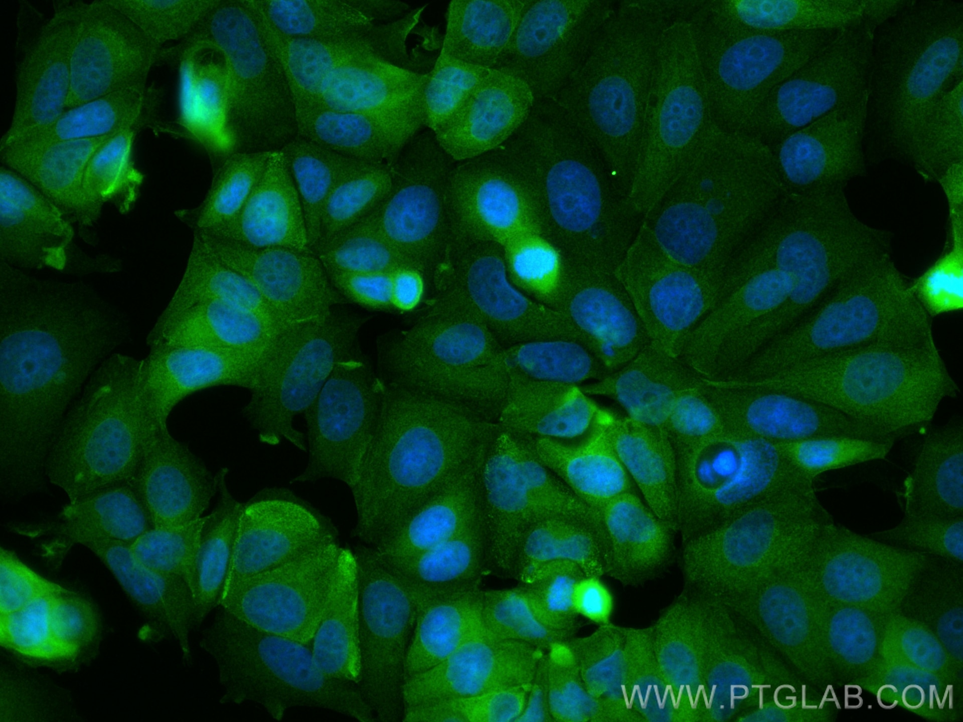 Immunofluorescence (IF) / fluorescent staining of MCF-7 cells using Melanophilin Polyclonal antibody (10338-1-AP)