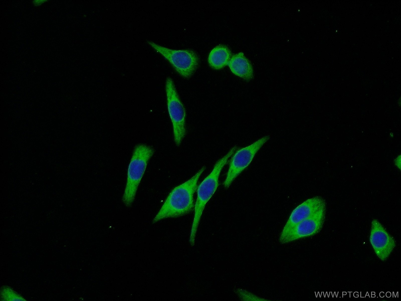 Immunofluorescence (IF) / fluorescent staining of HeLa cells using Melanophilin Polyclonal antibody (10338-1-AP)
