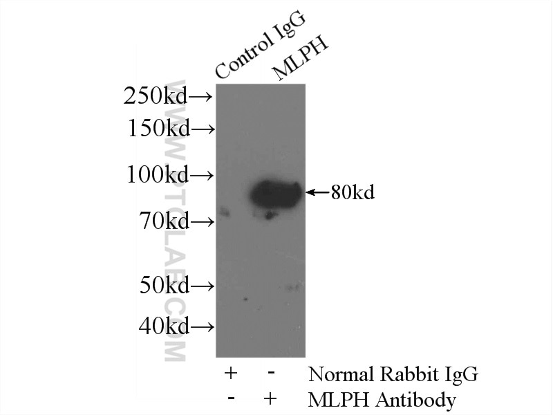 Immunoprecipitation (IP) experiment of A375 cells using Melanophilin Polyclonal antibody (10338-1-AP)