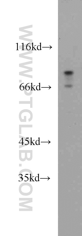 Western Blot (WB) analysis of A375 cells using Melanophilin Polyclonal antibody (10338-1-AP)