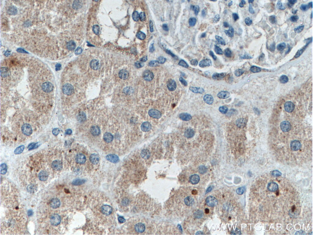 Immunohistochemistry (IHC) staining of human kidney tissue using Melanophilin Monoclonal antibody (66092-1-Ig)