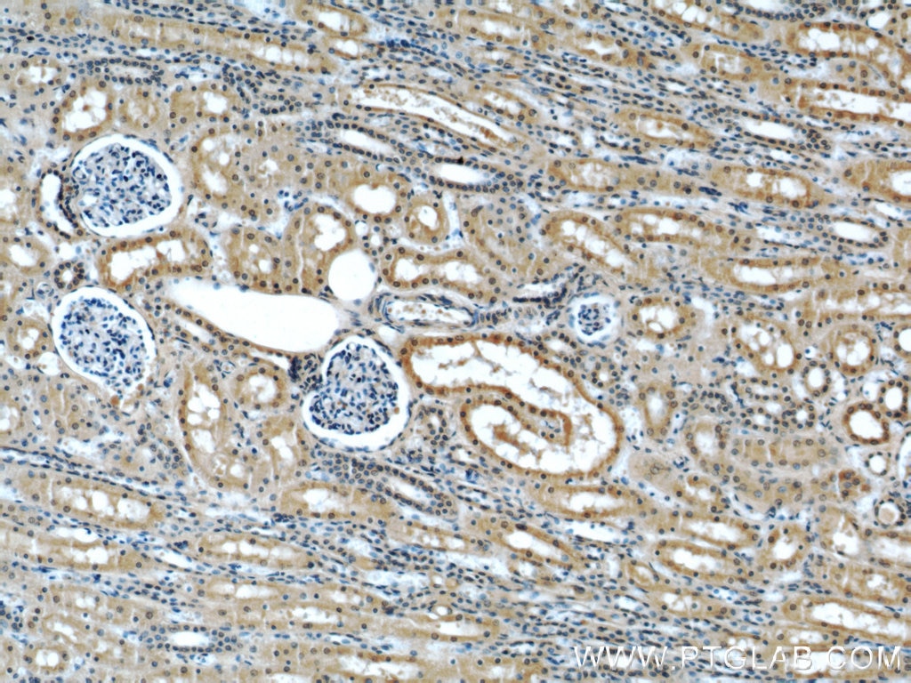Immunohistochemistry (IHC) staining of human kidney tissue using Melanophilin Monoclonal antibody (66092-1-Ig)