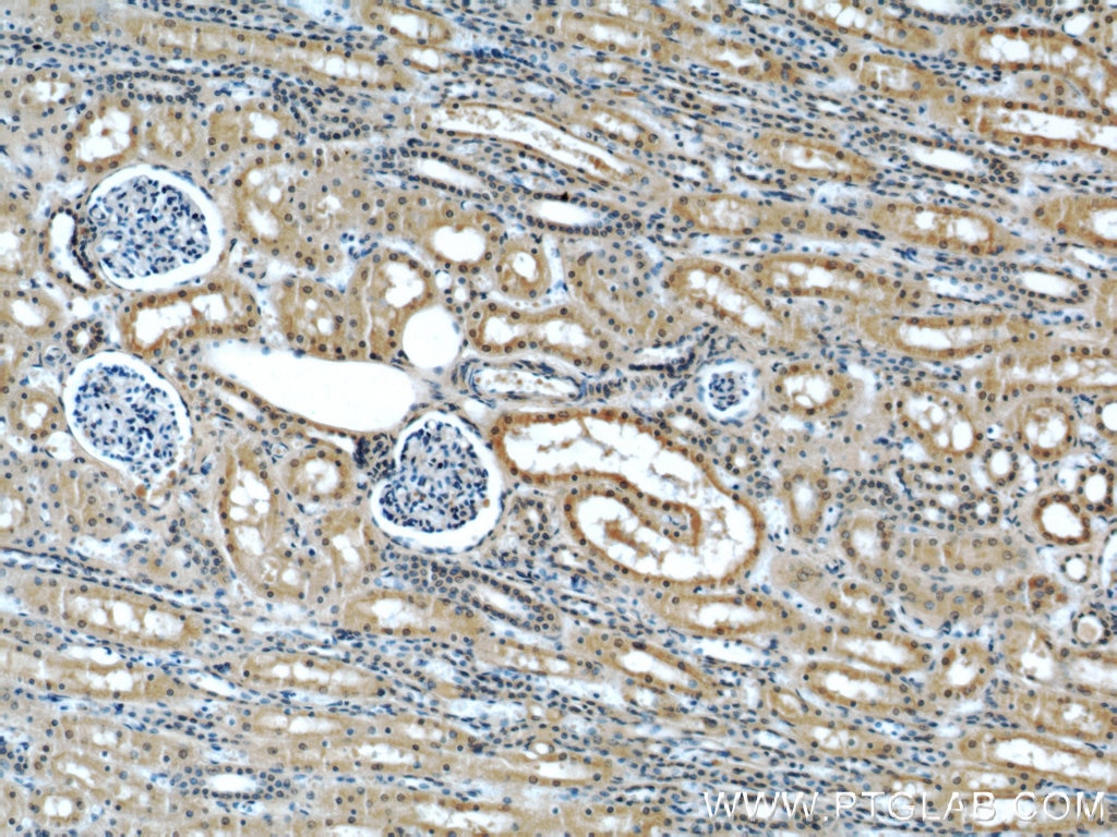 IHC staining of human kidney using 66092-1-Ig